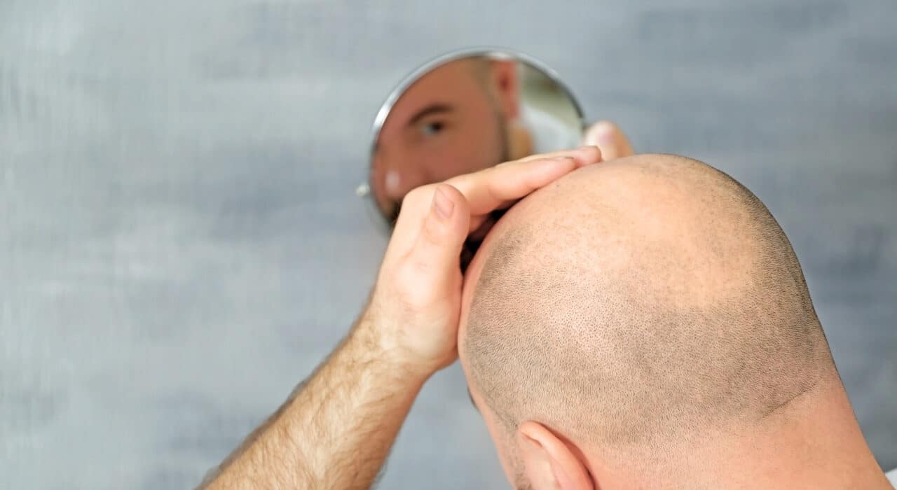 Bild på en man som tappar hår
