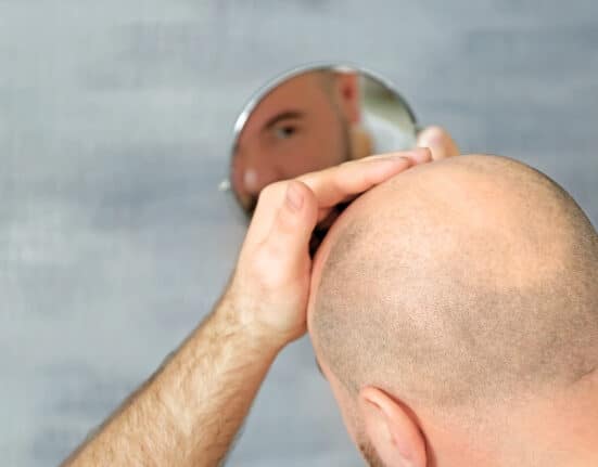 Bild på en man som tappar hår